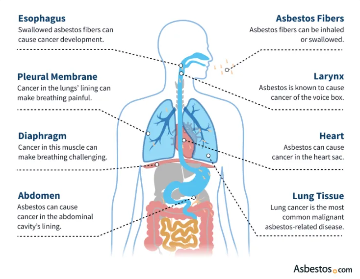 Asbestos Diagram