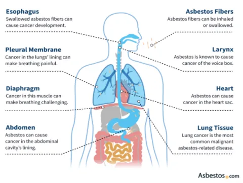 Asbestos Found in Gaskets